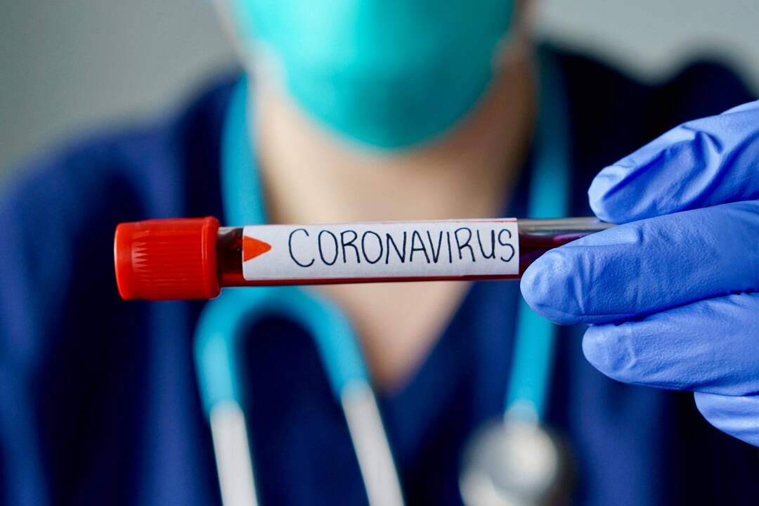 coronavirus-provetta-