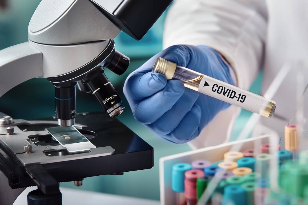 coronavirus-test-sierologico